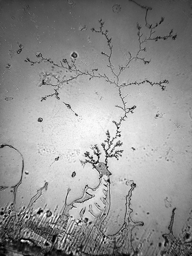 Larmes vues à travers un microscope. Rose Lynn Fisher. 2008.