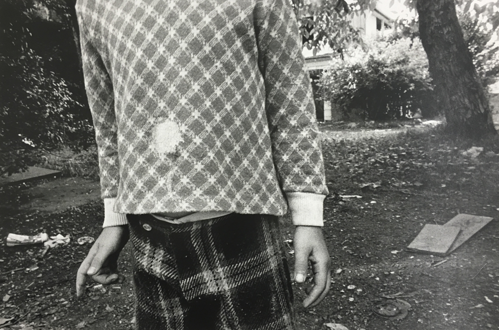 Mark Cohen : Hole in Shirt, 1974